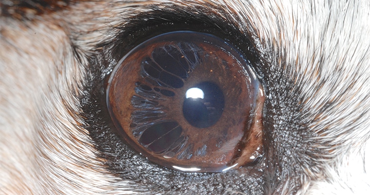 pseudopolycoria-due-to-iris-atrophy3